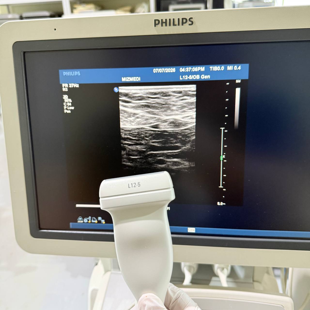 필립스 iU22 Ultrasound Machine - photo 8