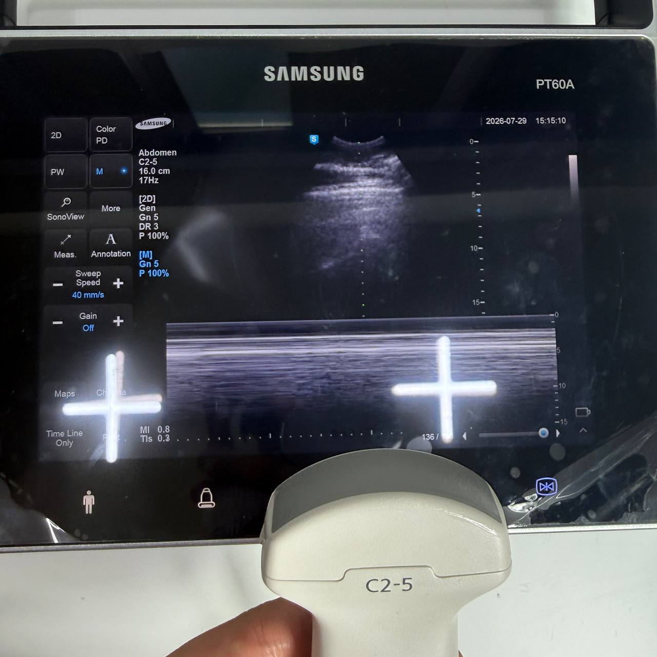 삼성메디슨 PT60A Ultrasound System - photo 9