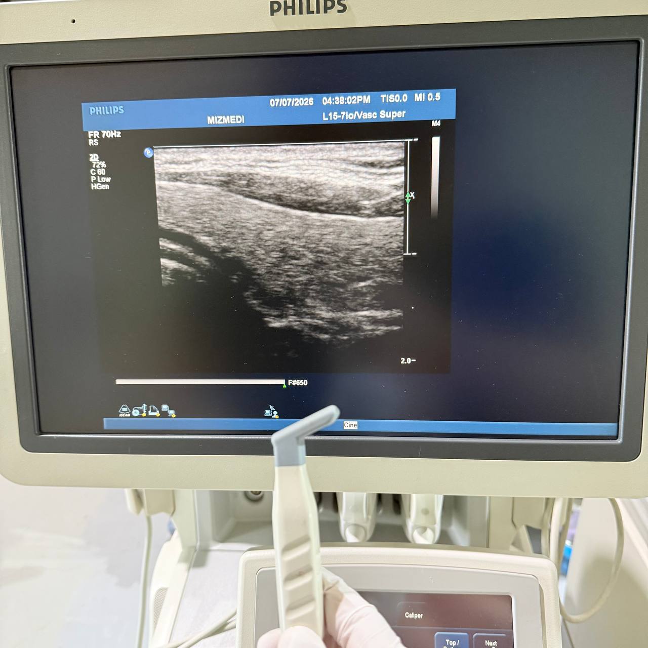 필립스 iU22 Ultrasound Machine - photo 9