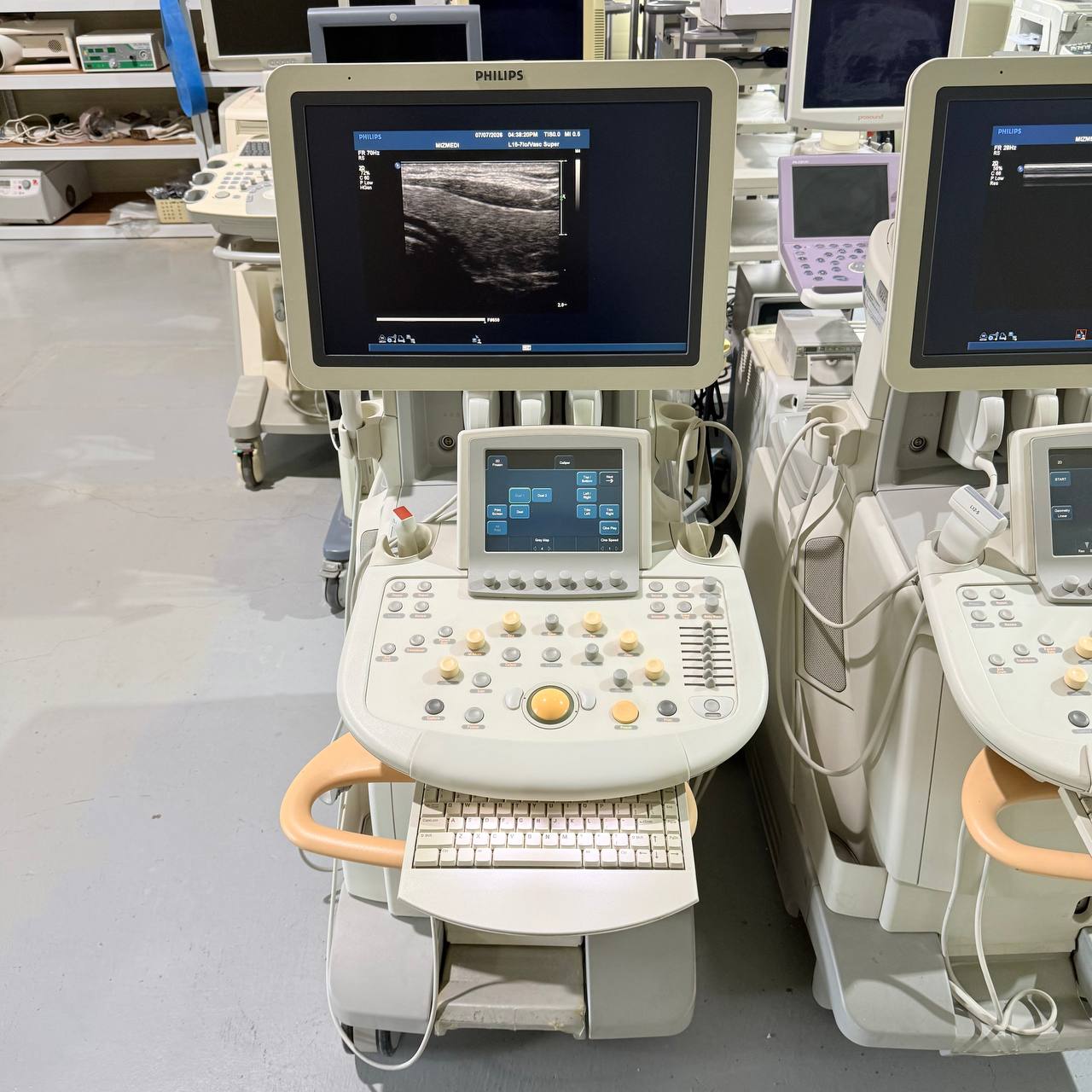 필립스 iU22 Ultrasound Machine - photo 10