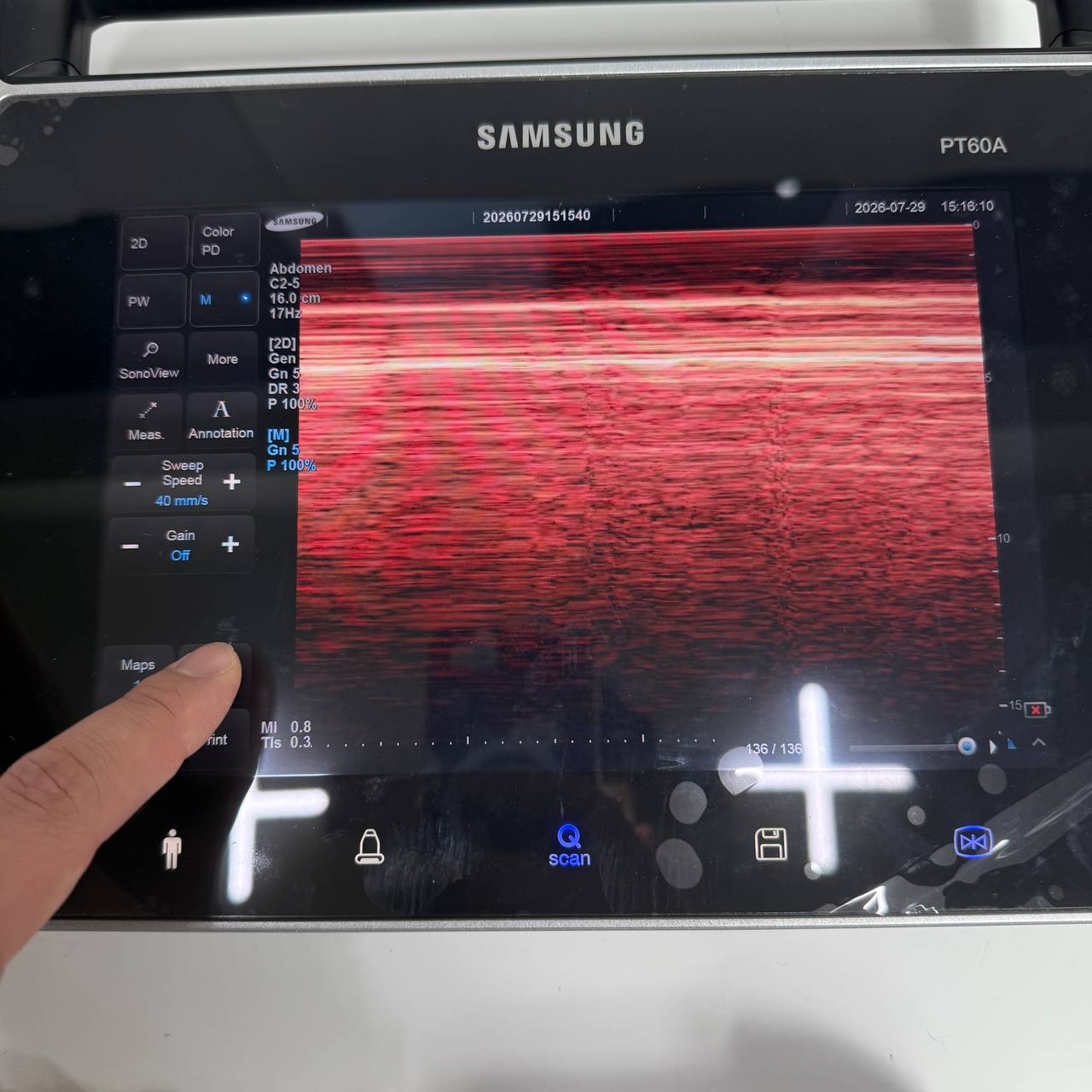 삼성메디슨 PT60A Ultrasound System - photo 10