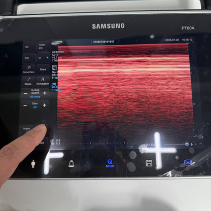 삼성메디슨 PT60A Ultrasound System - photo 10