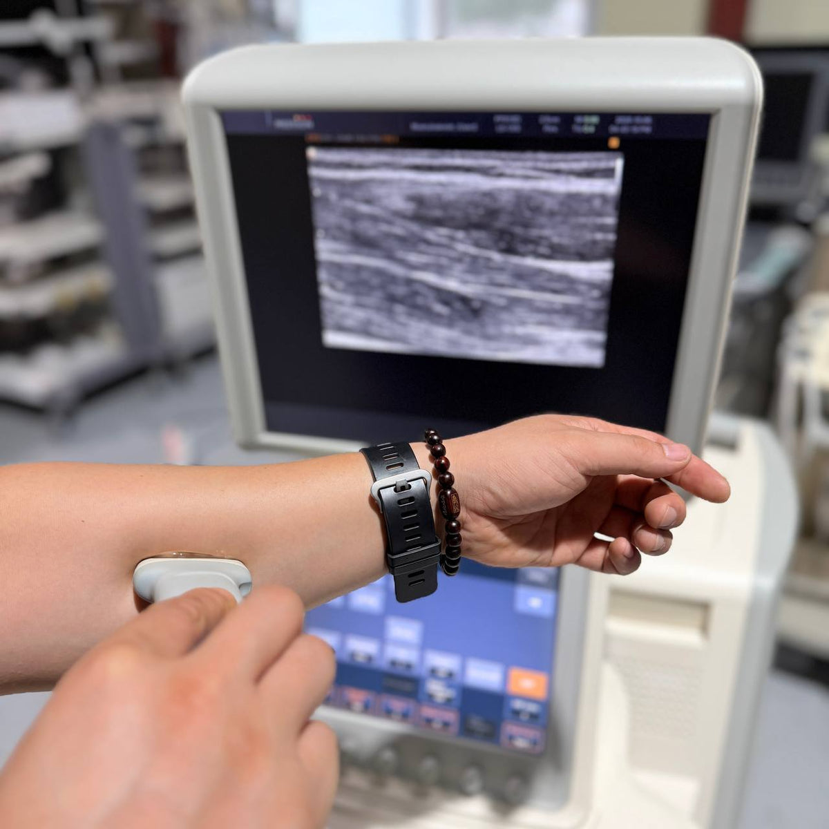 삼성메디슨 Accuvix V20 Ultrasound System - photo 11