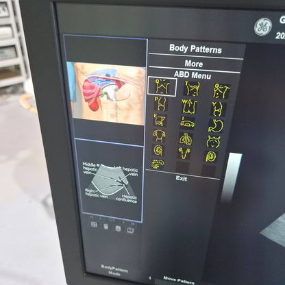 Used GE HealthCare Versana Balance (2021) Ultrasound Machine for Sale