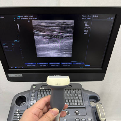 알피니언 E-CUBE 7 Ultrasound System - photo 11