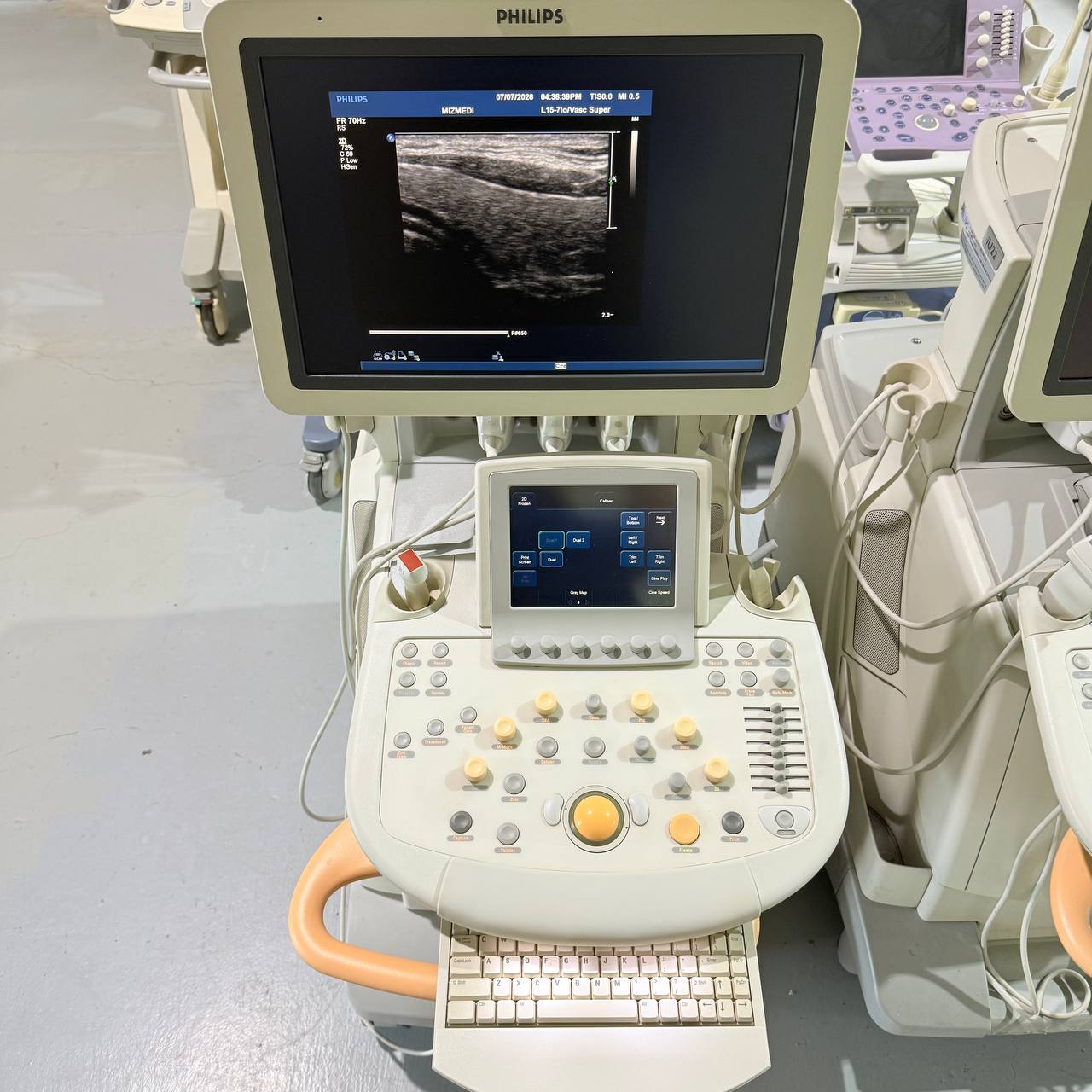 필립스 iU22 Ultrasound Machine - photo 12