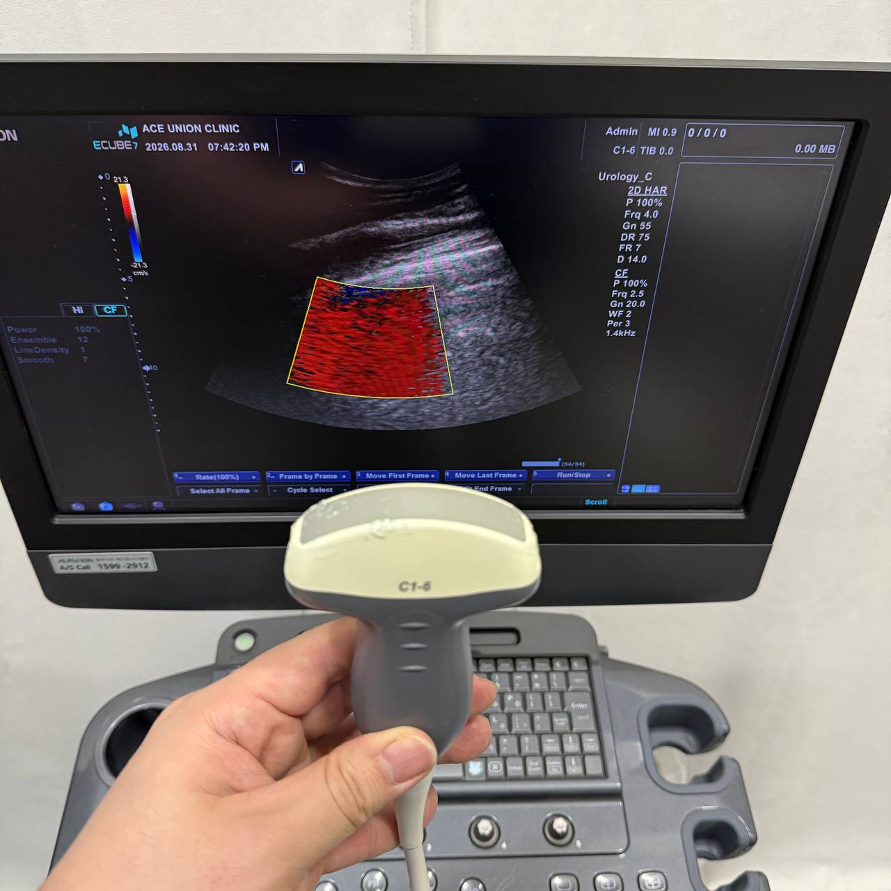 알피니언 E-CUBE 7 Ultrasound System - photo 12