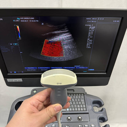 알피니언 E-CUBE 7 Ultrasound System - photo 12