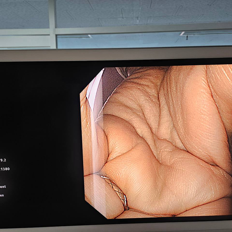 올림푸스 GIF-Q260 Flexible Gastroscope - photo 13