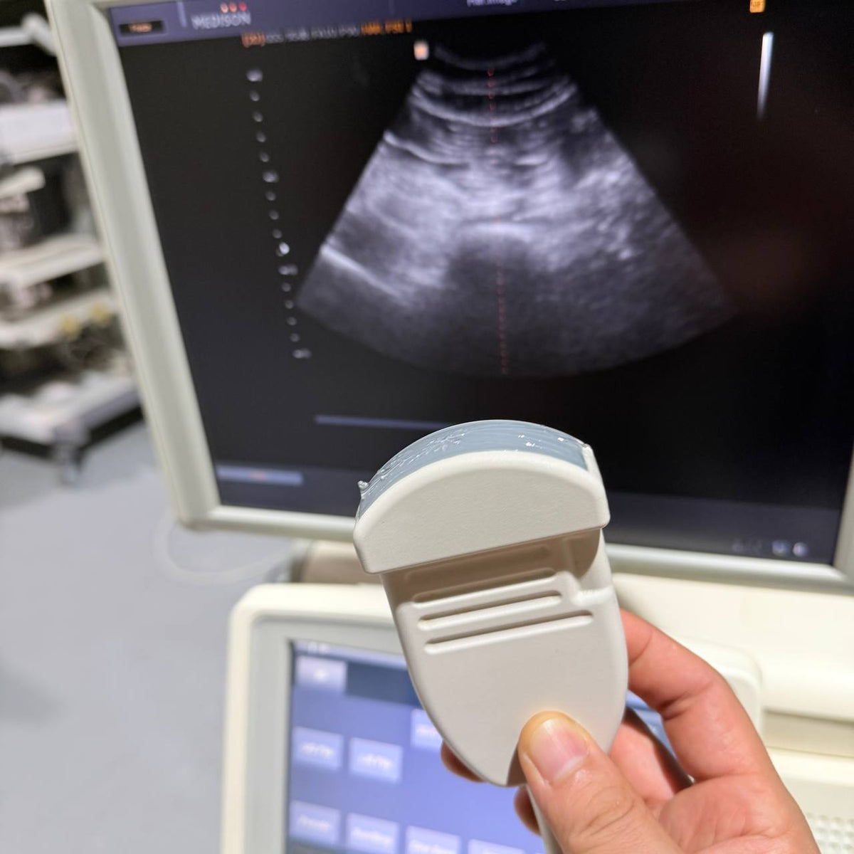 삼성메디슨 Accuvix V20 Ultrasound System - photo 13
