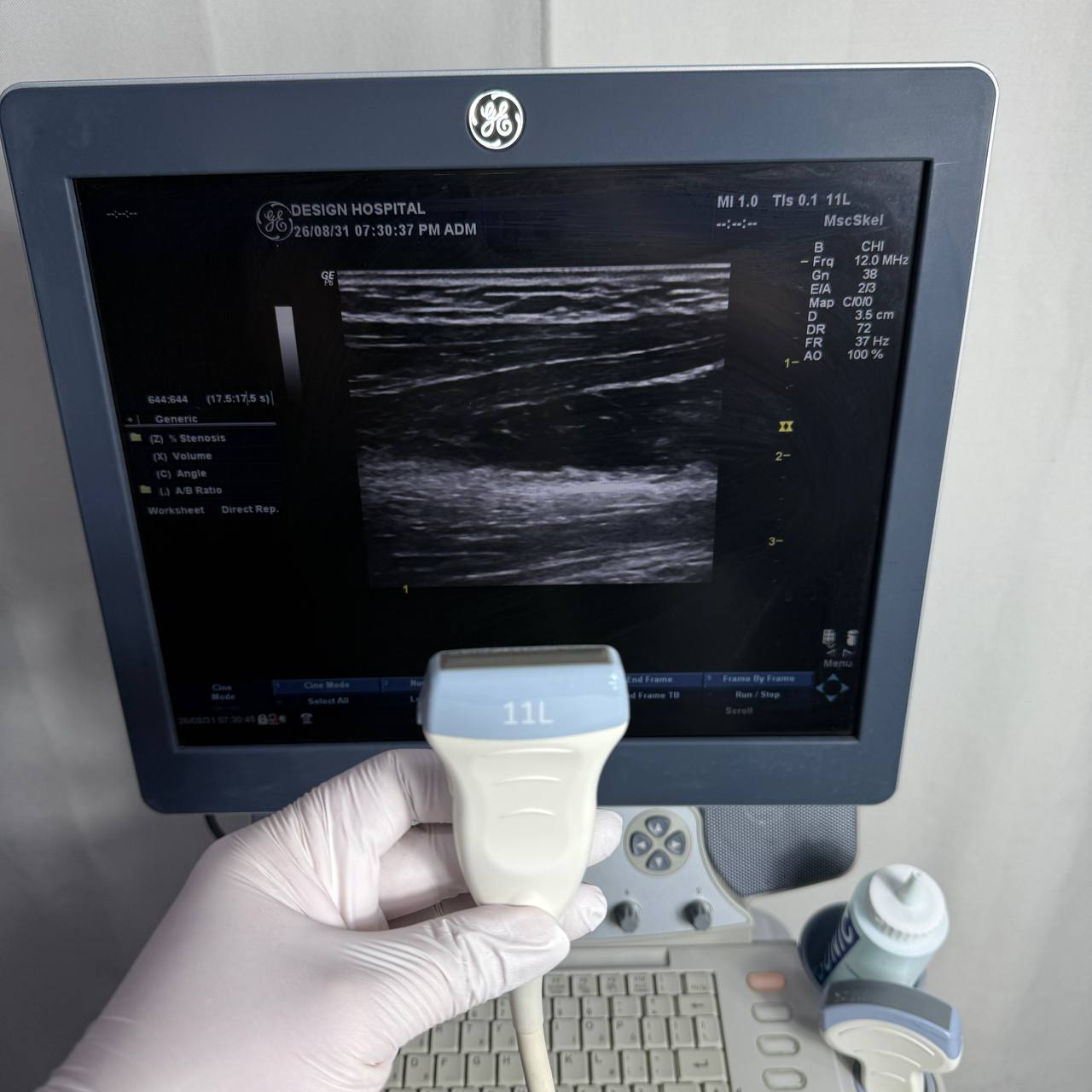GE헬스케어 로직 P6 (LOGIQ P6) Ultrasound System - photo 13