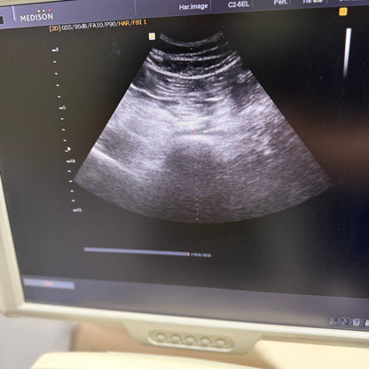 삼성메디슨 Accuvix V20 Ultrasound System - photo 14