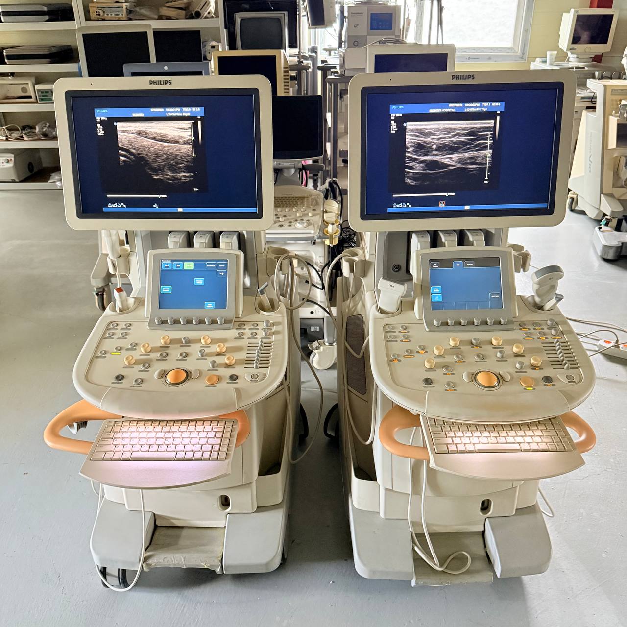 필립스 iU22 Ultrasound Machine - photo 15