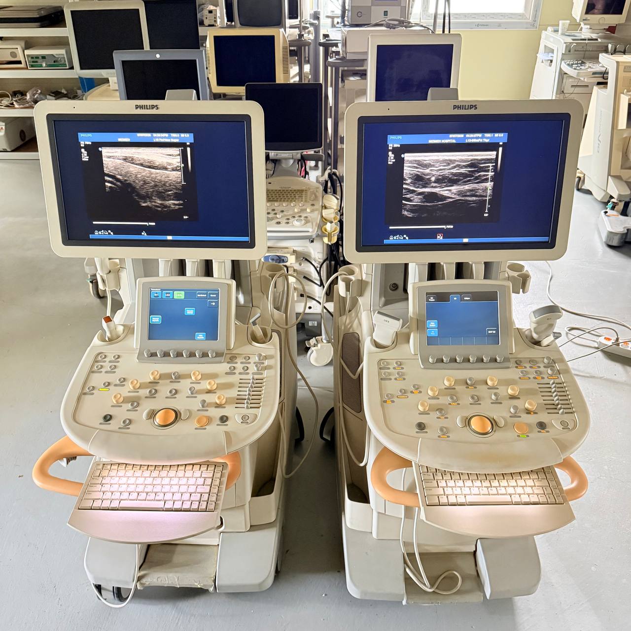 필립스 iU22 Ultrasound Machine - photo 16