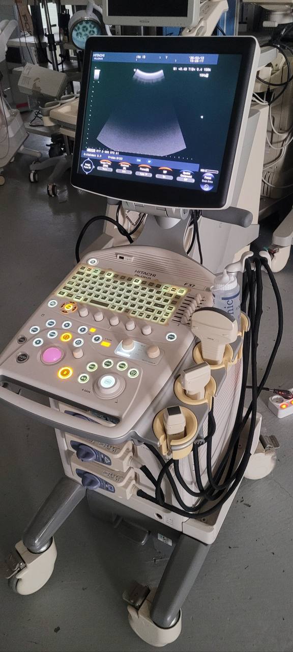 히타치 알로카 F37 Ultrasound System - photo 16
