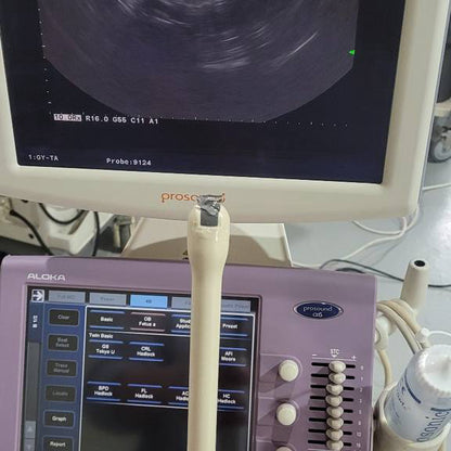 알로카 ProSound Alpha 6 Ultrasound System - photo 16