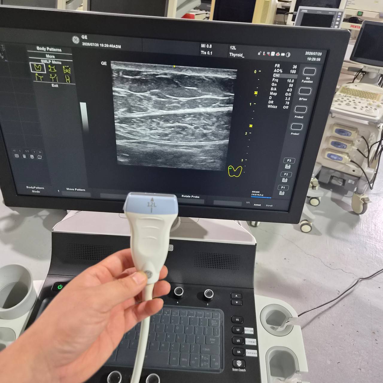 Used GE HealthCare Versana Balance (2021) Ultrasound Machine for Sale