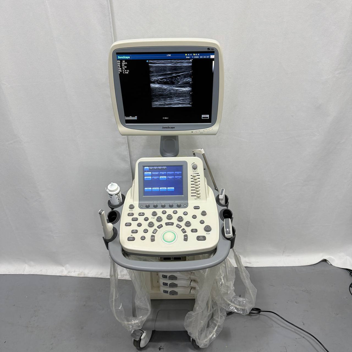 소노스케이프 S20 Ultrasound System - photo 17