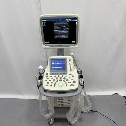 소노스케이프 S20 Ultrasound System - photo 17