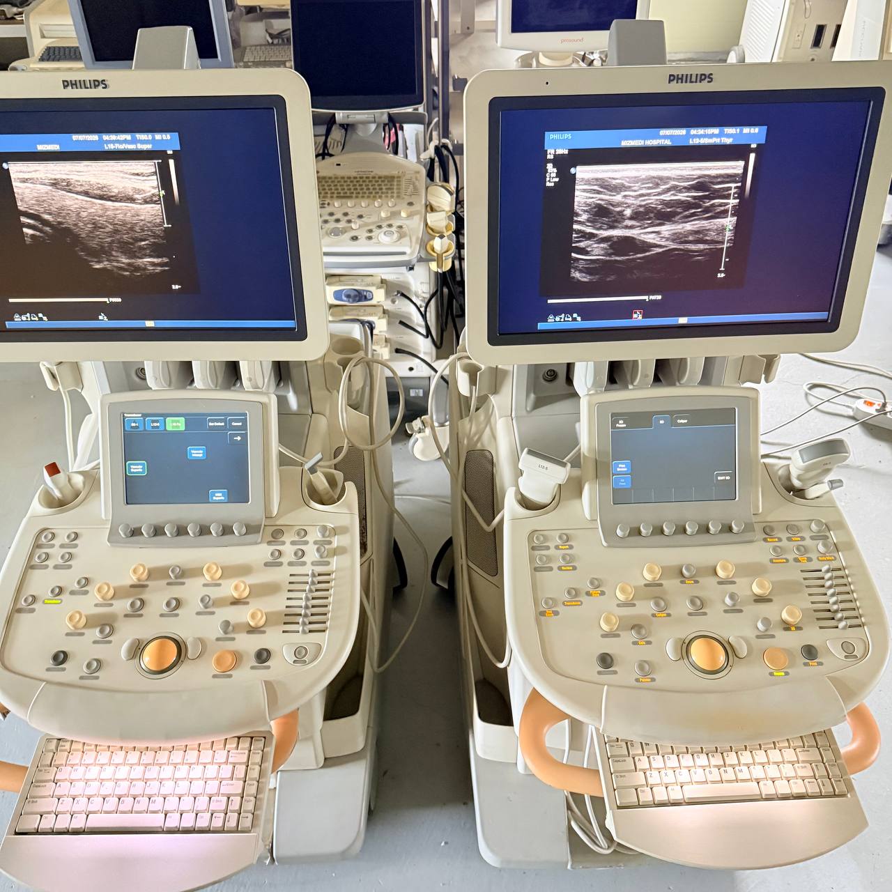 필립스 iU22 Ultrasound Machine - photo 18