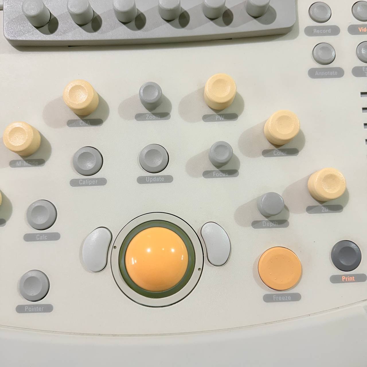 필립스 iU22 Ultrasound Machine - photo 20