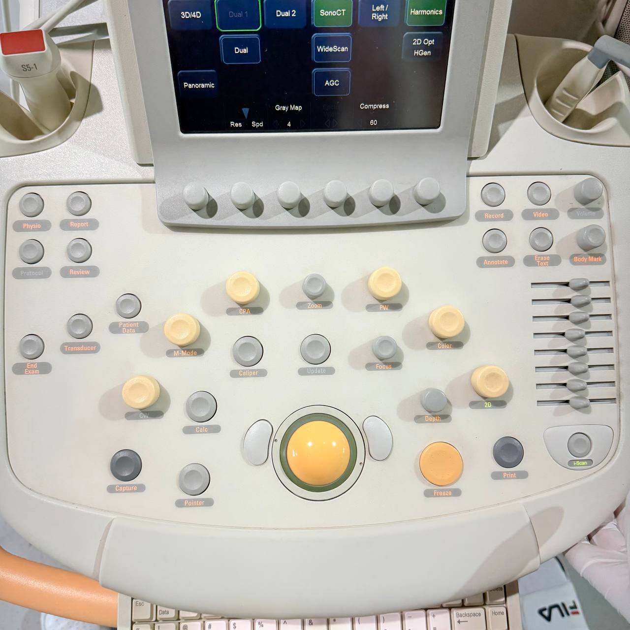 필립스 iU22 Ultrasound Machine - photo 22
