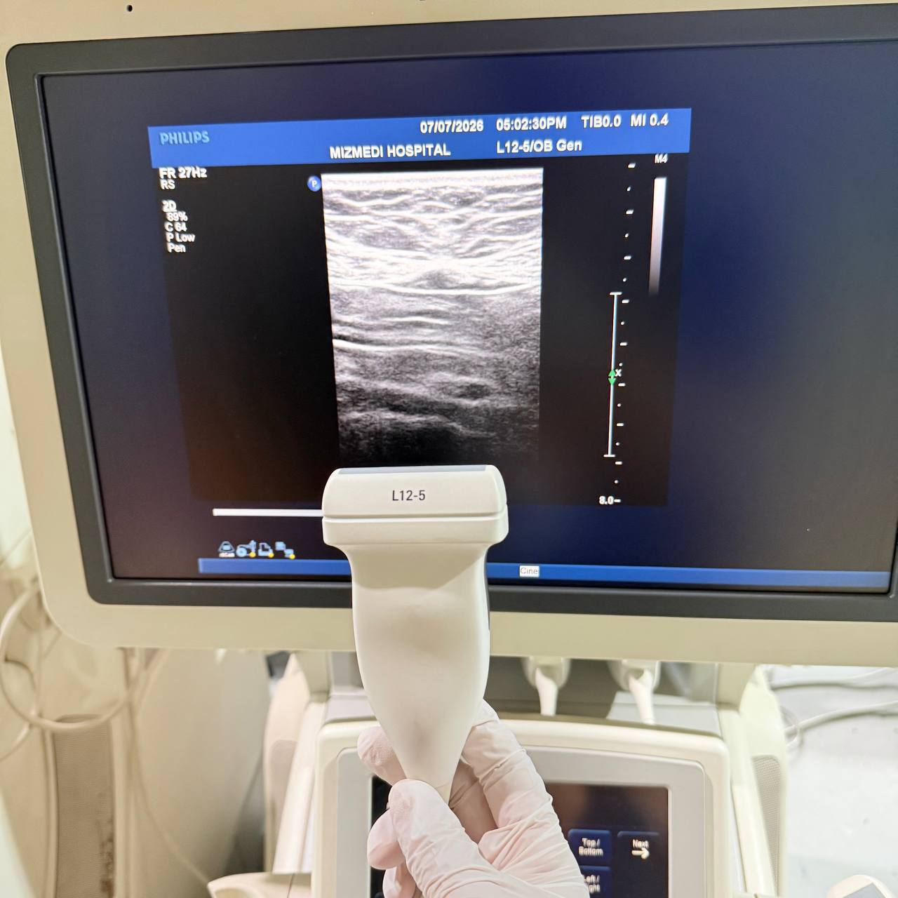 필립스 iU22 Ultrasound Machine - photo 23