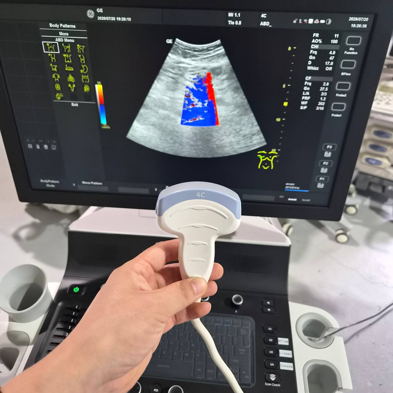 Used GE HealthCare Versana Balance (2021) Ultrasound Machine for Sale
