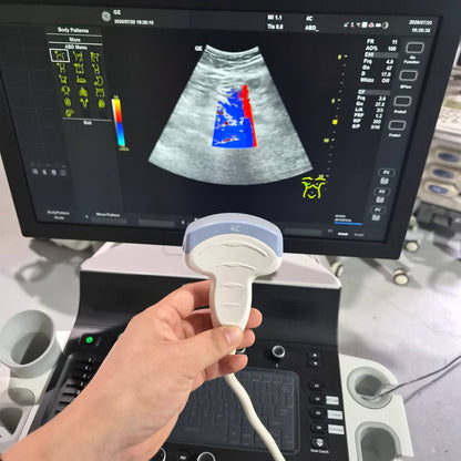 Used GE HealthCare Versana Balance (2021) Ultrasound Machine for Sale