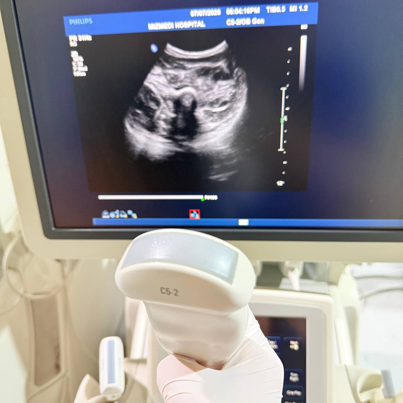 필립스 iU22 Ultrasound Machine - photo 25