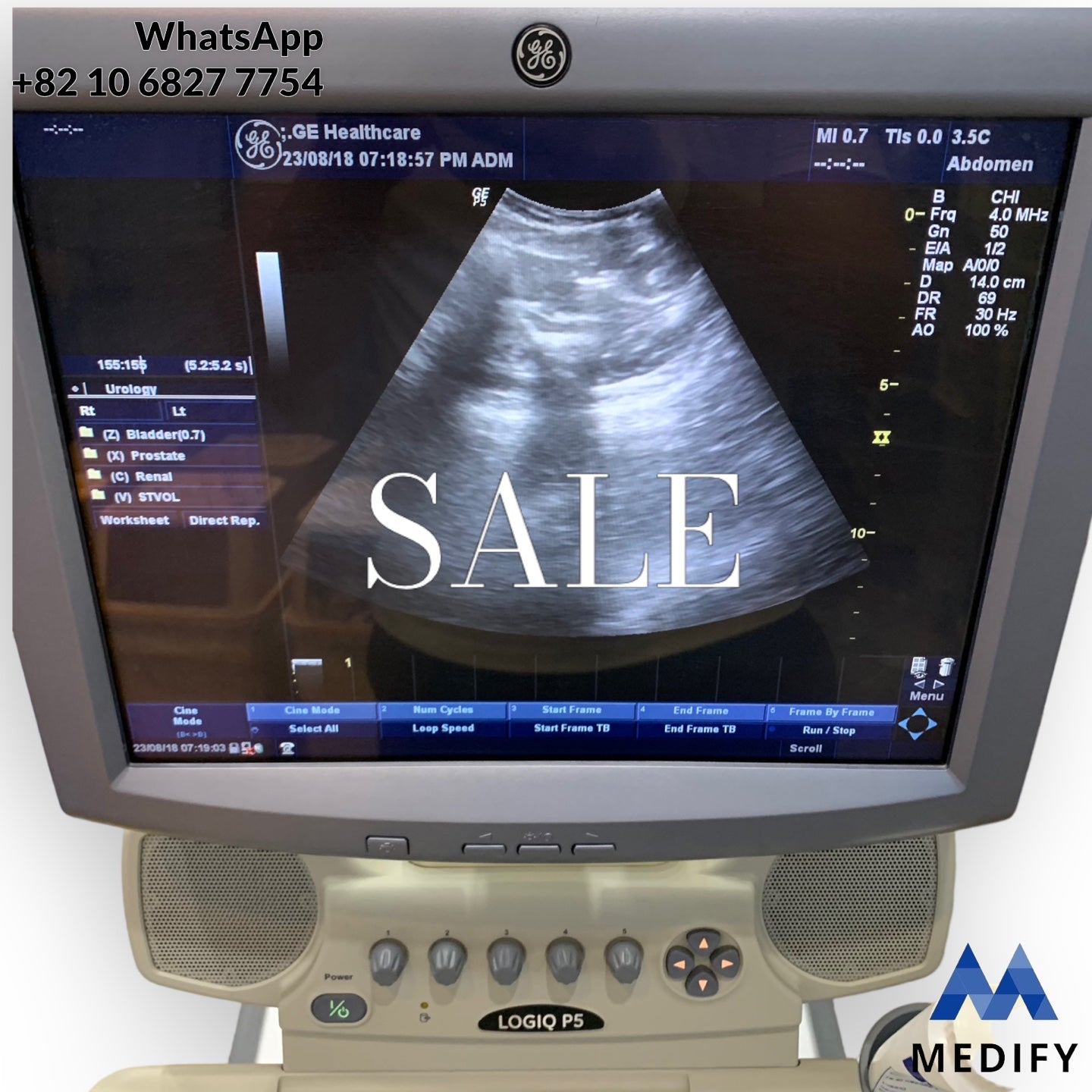 GE LOGIQ P5 Ultrasound System & 2 Probe