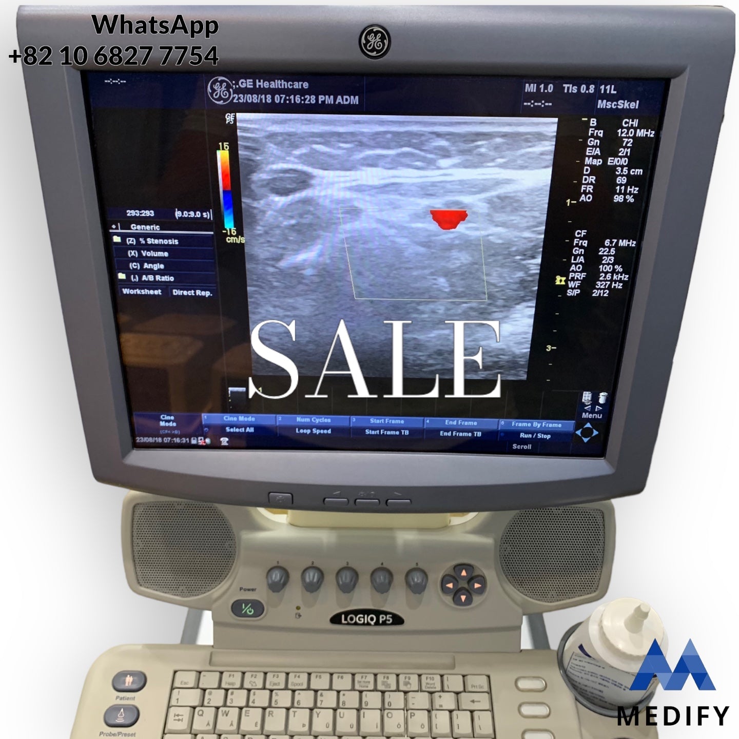 GE LOGIQ P5 Ultrasound System & 2 Probe