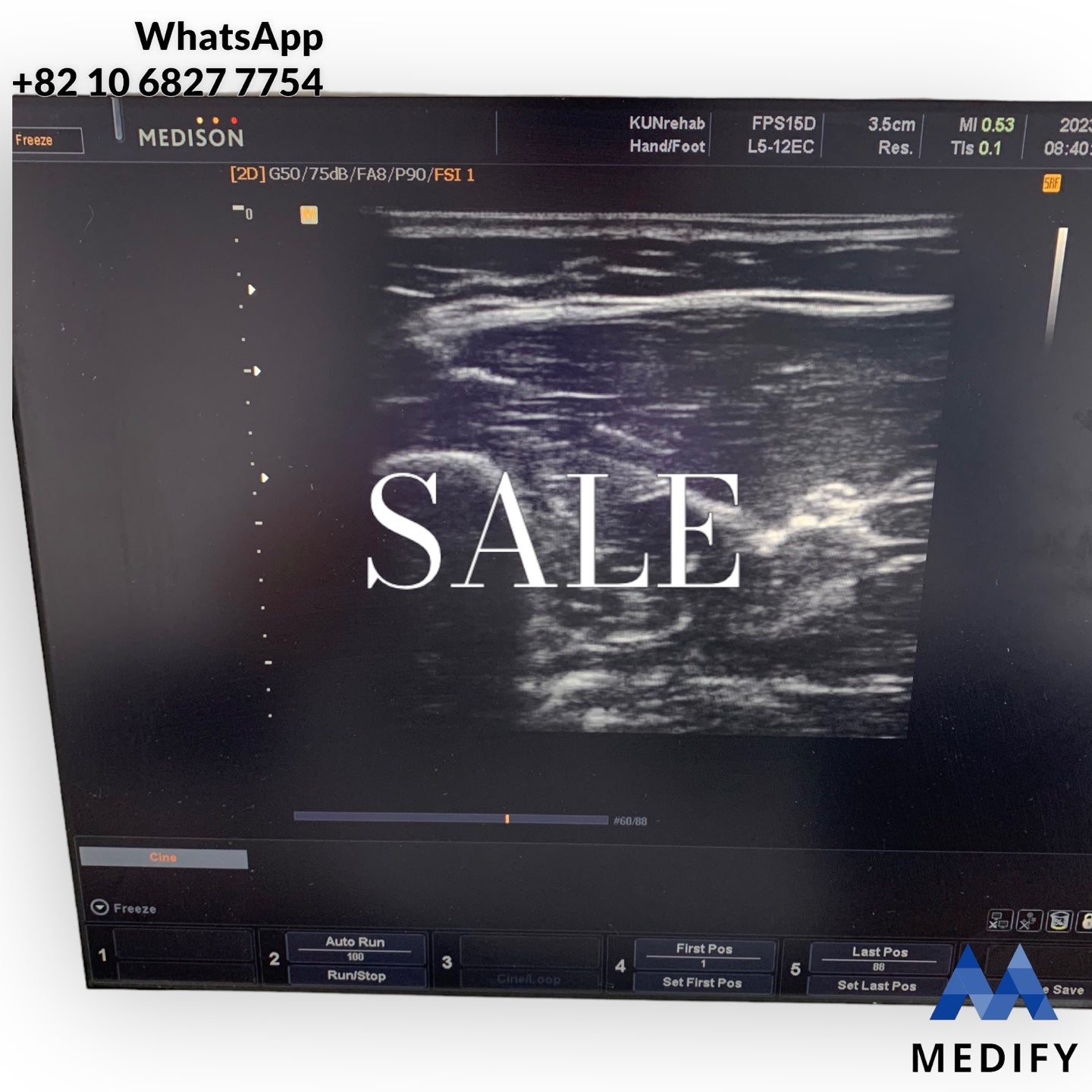 Samsung Medison SonoAce X8 Ultrasound System & 2 Probe