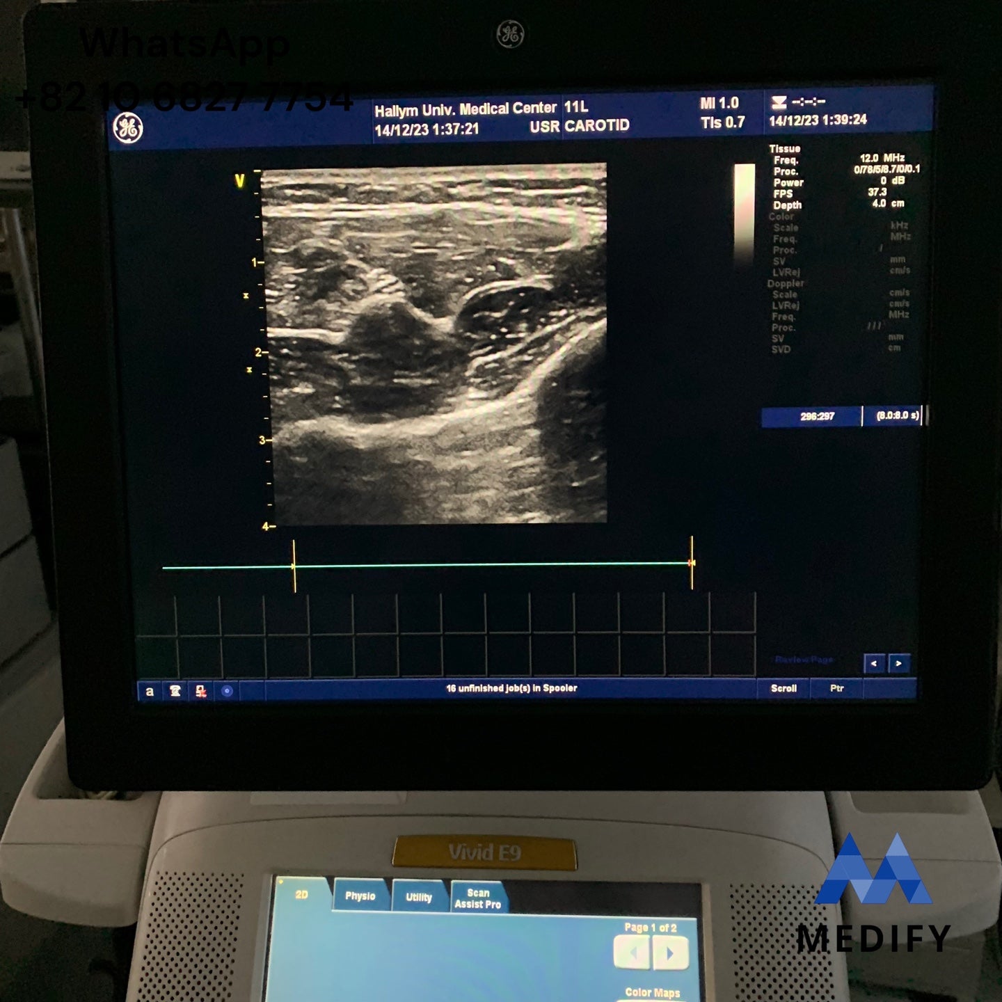 GE Vivid E9 Ultrasound System & 2 Probe