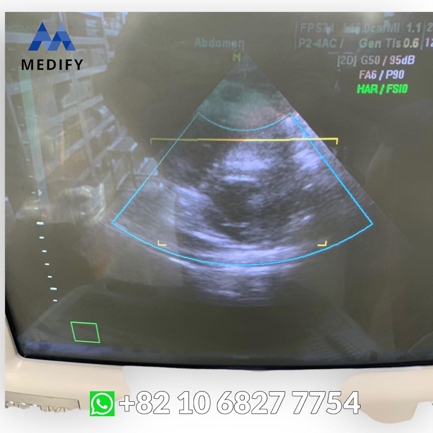 ($1,500) Medison Accuvix XQ Ultrasound System & Cardiac Linear Convex Probe - 3D/4D Software