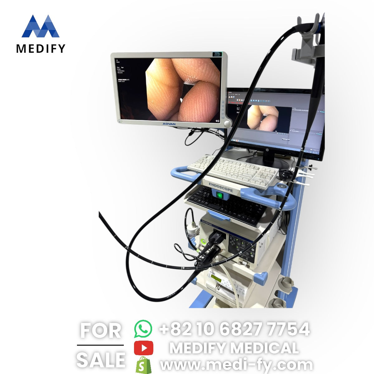 ($23,000) Olympus CV-170 Endoscopy System Full Set & GIF-H170 Gastroscope