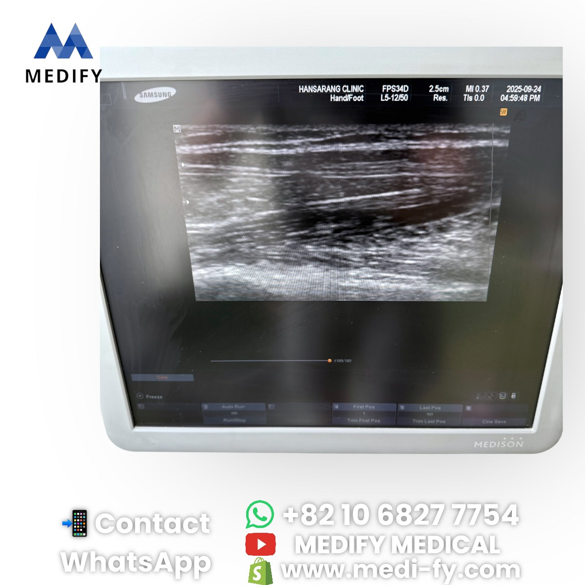 For Sale Used Medison Sonoace R7 Ultrasound