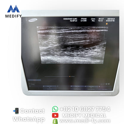 For Sale Used Medison Sonoace R7 Ultrasound