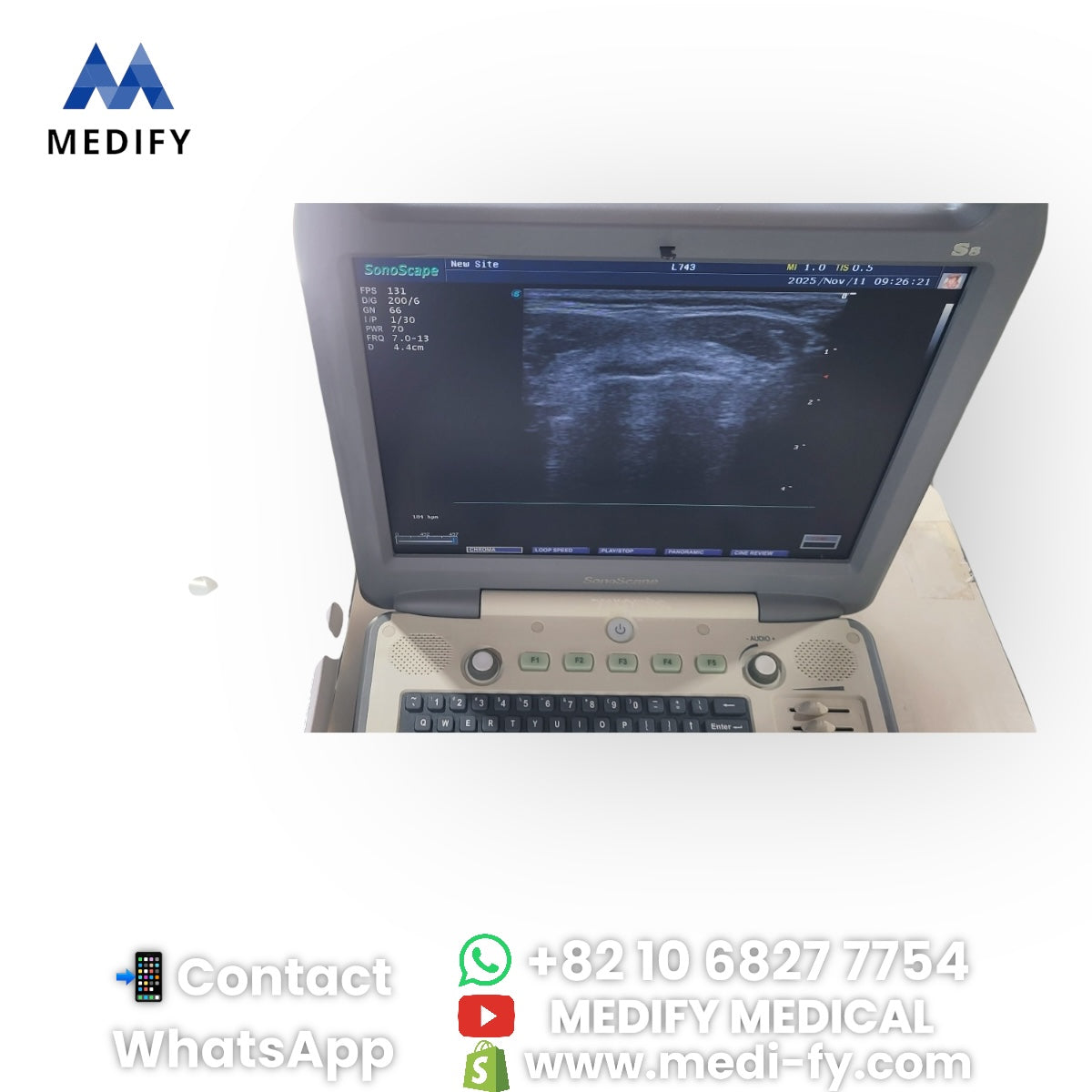 For Sale Used Sonoscape S8 Portable Ultrasound & 3Probes