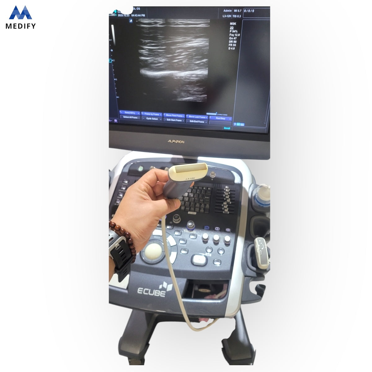 Used Alpinion Ecube9 Ultrasound - 2Probes Convex Linear For Sale