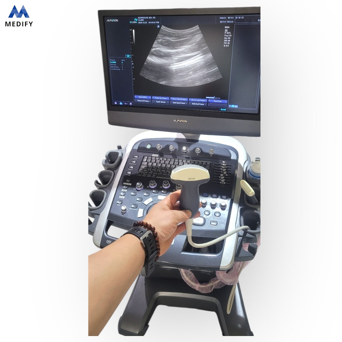 Used Alpinion Ecube9 Ultrasound - 2Probes Convex Linear For Sale