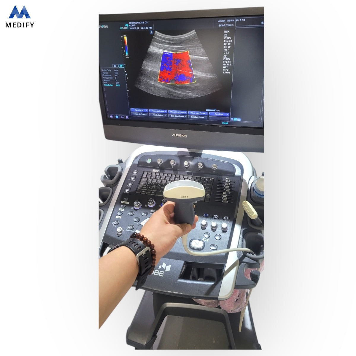 Used Alpinion Ecube9 Ultrasound - 2Probes Convex Linear For Sale