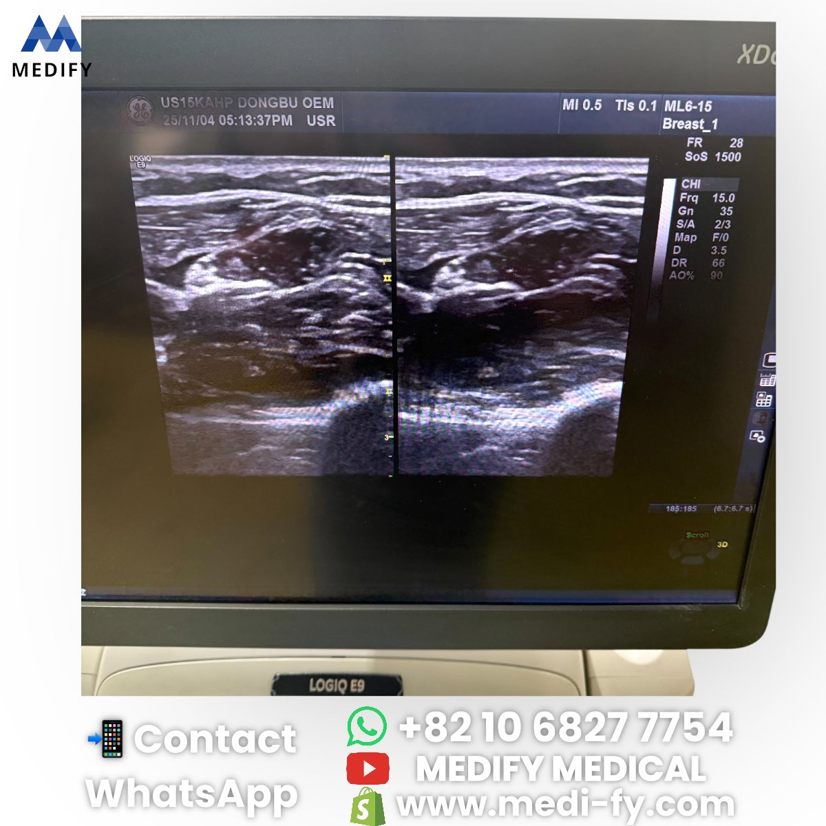 For Sale GE Logiq E9 XDclear 2.0 Ultrasound - 2Probe