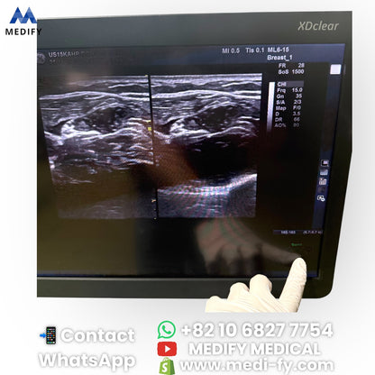 For Sale GE Logiq E9 XDclear 2.0 Ultrasound - 2Probe