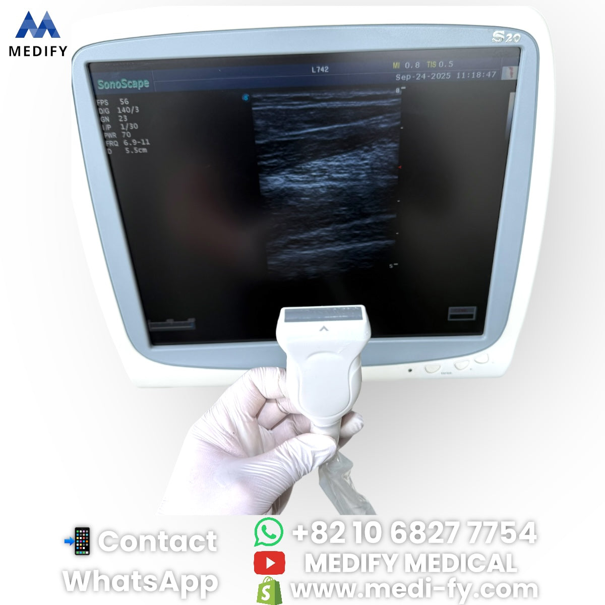 For Sale Sonoscape S20 Ultrasound System - 3Probes