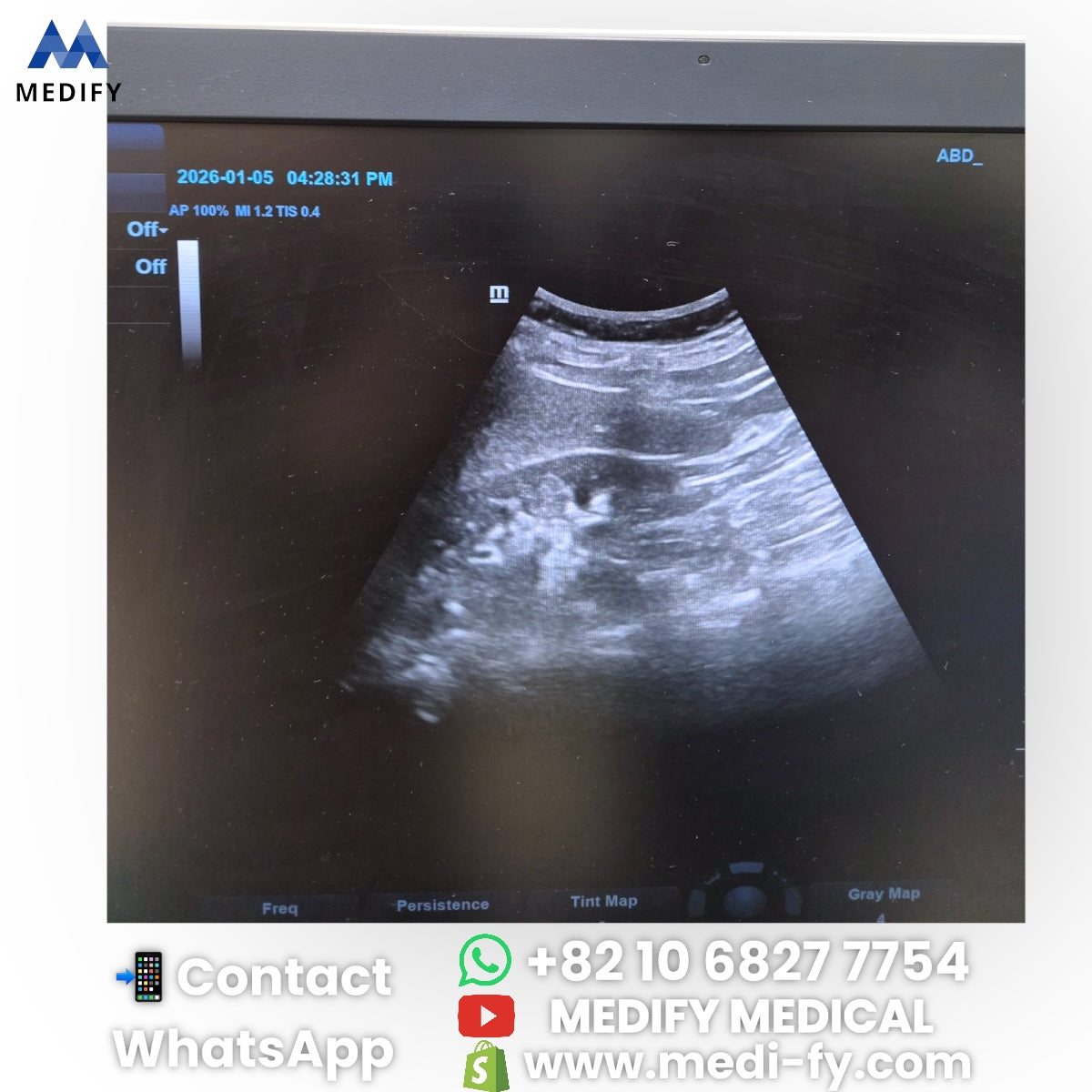 For Sale Mindray DC-40 Exp Ultrasound System 3Probes YOM 2021