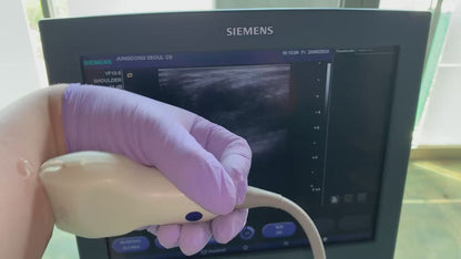 ($1,900) Siemens Acuson X300 Ultrasound System & Linear Probe  - Worldwide