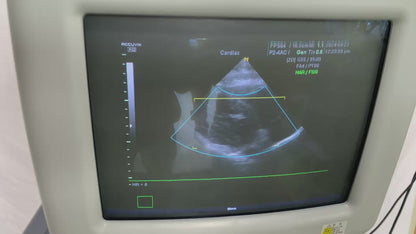 ($1,500) Medison Accuvix XQ Ultrasound System & Cardiac Linear Convex Probe - 3D/4D Software