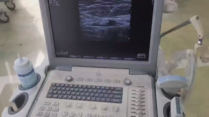 ($5,900) Used SonoScape S8 Portable Ultrasound & 2Probes