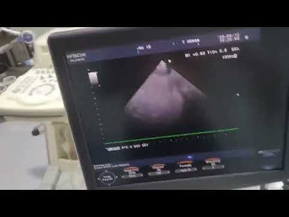 Used Hitachi Aloka F37 Ultrasound System for Sale